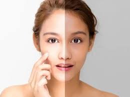 Skin Brightening Facial